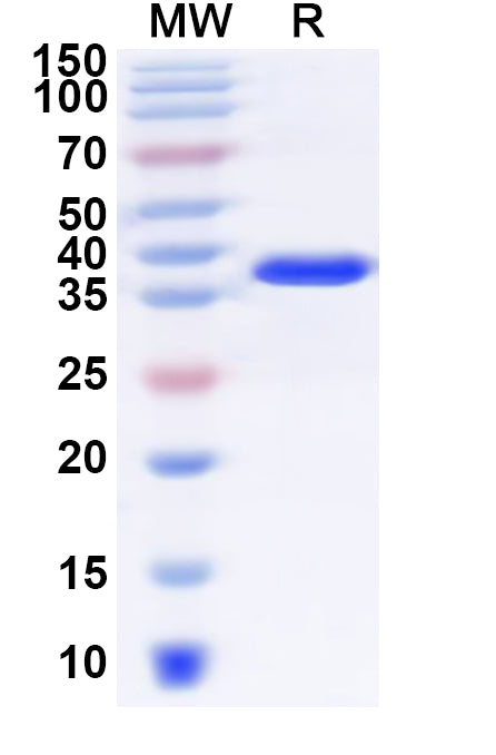 Recombinant Human SLC13A2 Protein, N-GST & C-His