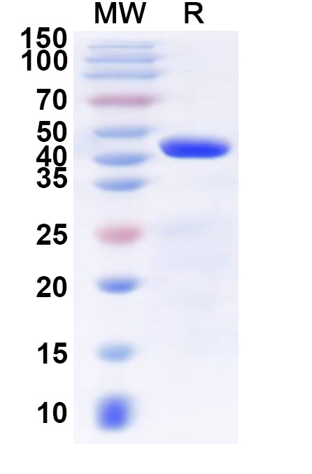 Recombinant Human SLC25A17 Protein, N-GST & C-His