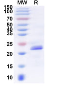 Recombinant Human GPR39 Protein, N-His