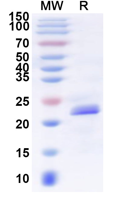 Recombinant Human GPR39 Protein, N-His