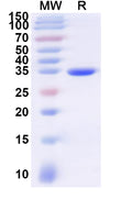 Recombinant Human AQP8 Protein, N-GST & C-His