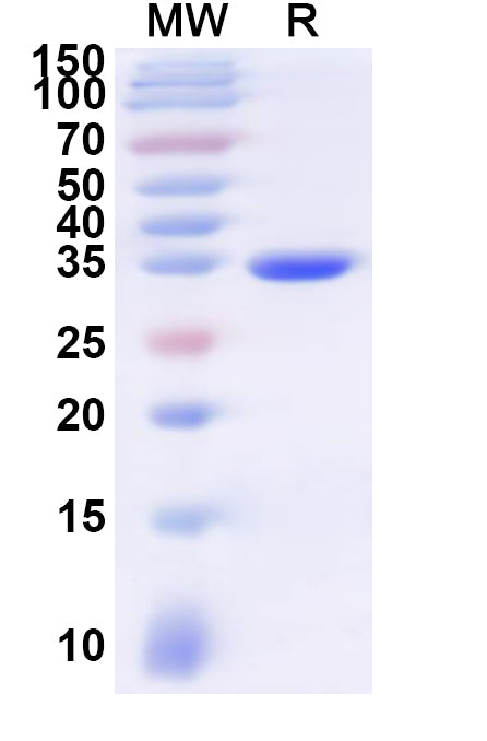 Recombinant Human AQP8 Protein, N-GST & C-His