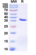 Recombinant Human BEST1 Protein, N-GST & C-His