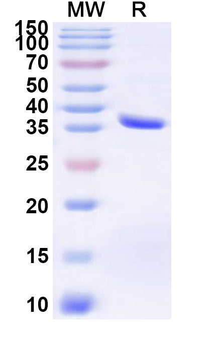 Recombinant Human BEST1 Protein, N-GST & C-His