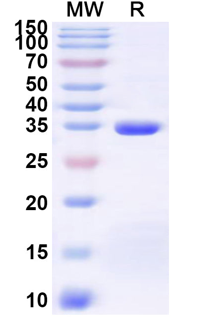 Recombinant Human SLC19A2 Protein, N-His-KSI