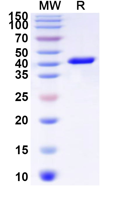 Recombinant Human GJB6 Protein, N-GST & C-His