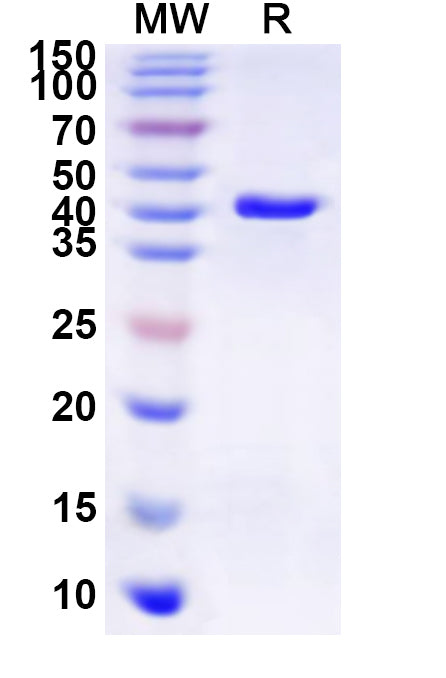 Recombinant Human GJB5 Protein, N-GST & C-His