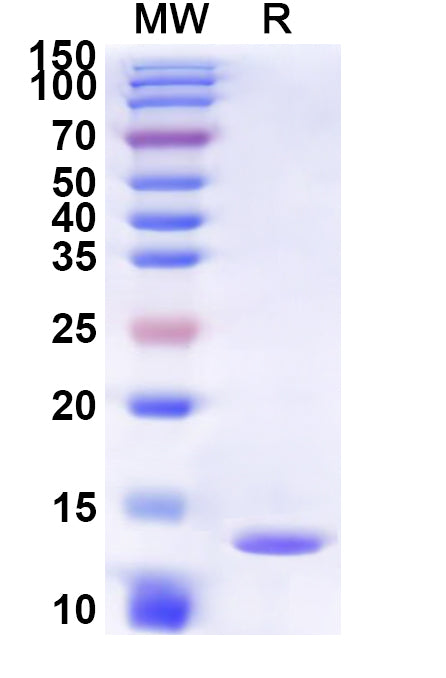 Recombinant Human CCKAR Protein, N-His-KSI