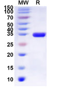 Recombinant Human OPRD1 Protein, N-His-KSI