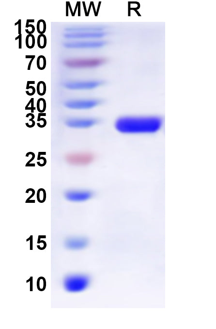 Recombinant Human OPRD1 Protein, N-His-KSI