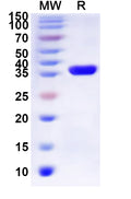 Recombinant Human P2RY2 Protein, N-His-KSI