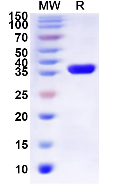 Recombinant Human P2RY2 Protein, N-His-KSI