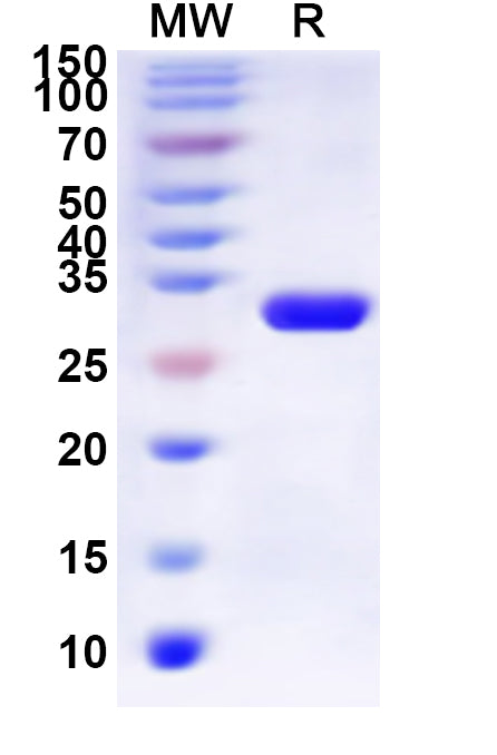 Recombinant Human CHRM5 Protein, N-His-KSI