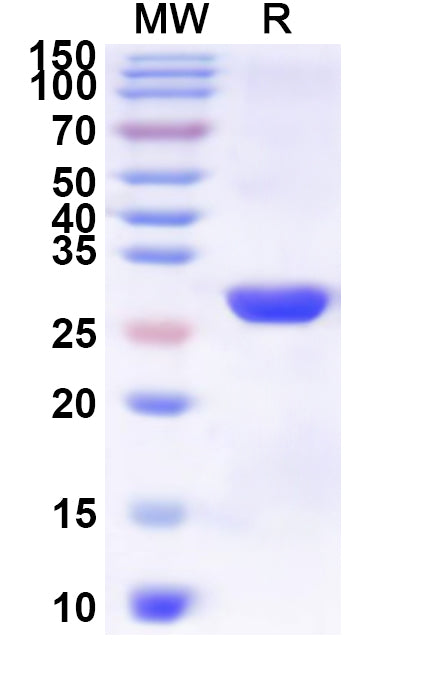 Recombinant Human SLC2A2 Protein, N-His-KSI