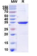 Recombinant Human MTNR1B Protein, N-His-KSI