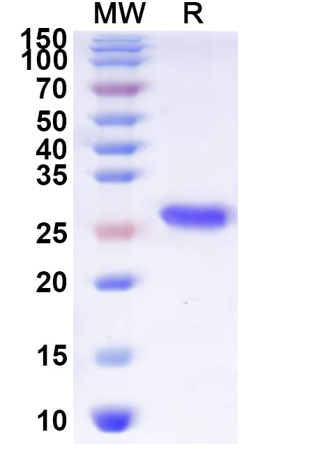 Recombinant Human MC3R Protein, N-His-KSI