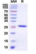 Recombinant Human GPER1 Protein, N-His-KSI