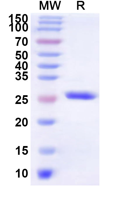 Recombinant Human GPER1 Protein, N-His-KSI