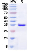 Recombinant Human P2RY1 Protein, N-His-KSI