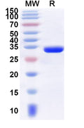 Recombinant Human UBAP2L Protein, N-GST & C-His