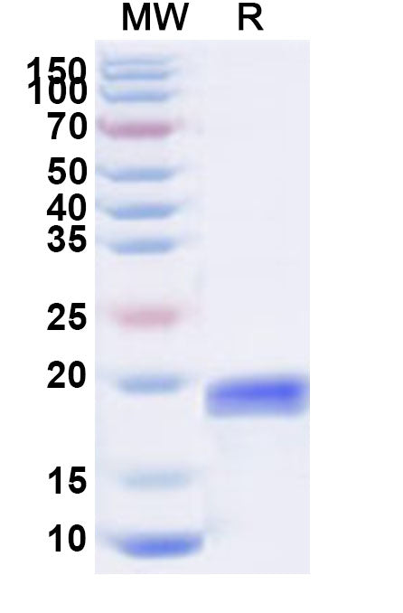 Recombinant Human LAIR2 Protein, N-His