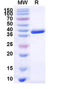 Recombinant Human ELOVL4 Protein, N-GST & C-His
