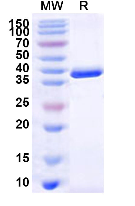 Recombinant Human ELOVL4 Protein, N-GST & C-His