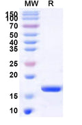 Recombinant Human NCAPH2 Protein, N-His