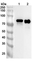 Western blot analysis was performed using anti-NCAPH2 polyclonal antibody at 1ug/mL on various samples.
Lane 1: Mouse brain lysate
Lane 2: Rat brain lysate