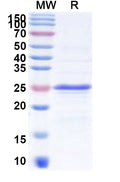 Recombinant Human CDSN Protein, N-His-KSI