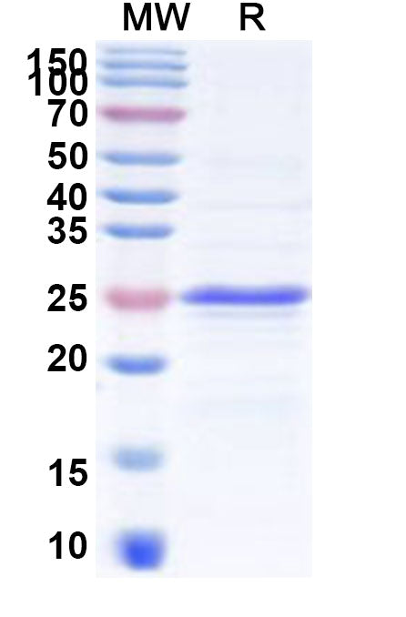 Recombinant Human CDSN Protein, N-His-KSI