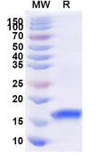 Recombinant Human MAPRE2 Protein, N-His