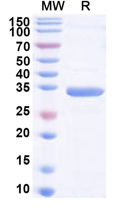Recombinant Human SLC35A1 Protein, N-GST & C-His