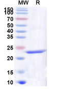 Recombinant Human SCD5 Protein, N-His
