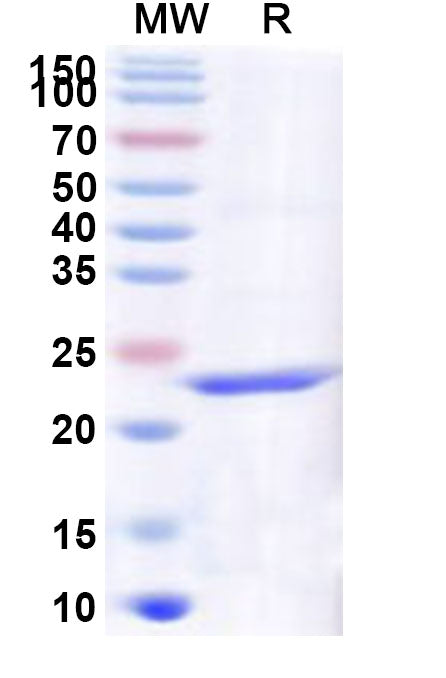 Recombinant Human SCD5 Protein, N-His