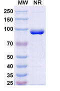 SDS-PAGE for Anti-Human FZD3/Frizzled-3 Nanobody (SAA2318)
