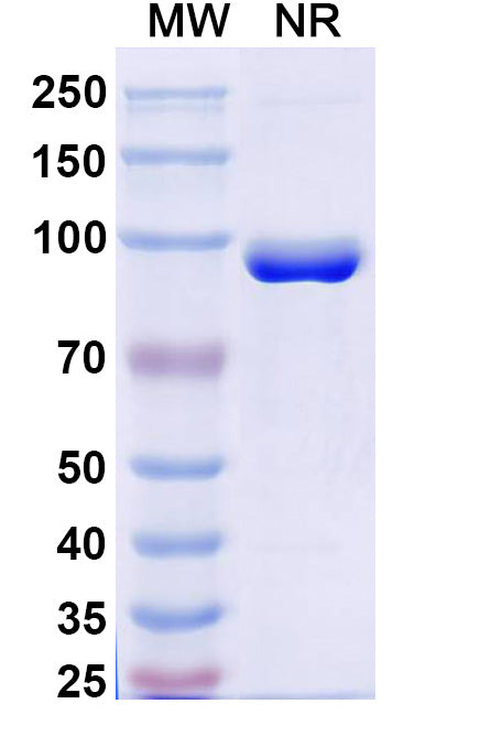 SDS-PAGE for Anti-Human FZD3/Frizzled-3 Nanobody (SAA2318)