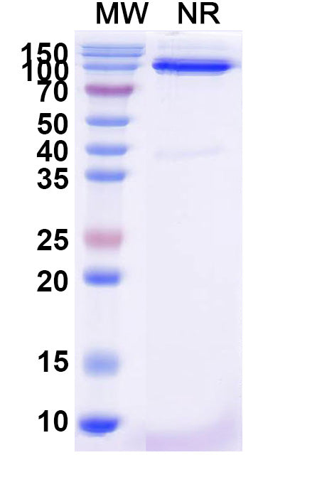 SDS-PAGE for Anti-Human FZD3/Frizzled-3 Nanobody (SAA2319)