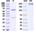 SDS-PAGE for Anti-Human FZD2 Antibody (SAA1676)