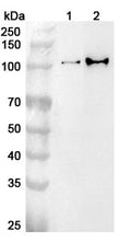 Western blot analysis was performed using anti-USP4  polyclonal antibody at 1ug/mL on various samples.
Lane 1: Hela cell lysate
Lane 2: Jurkat cell lysate