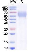 Recombinant Human TPBG/5T4 Protein, C-His