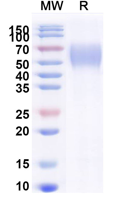 Recombinant Human TPBG/5T4 Protein, C-His