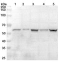 Western blot analysis was performed using anti-HSPA14 polyclonal antibody at 1μg/ml on various samples.
Lane 1: SW620 cell lysate
Lane 2: Jurkat cell lysate
Lane 3: K562 cell lysate
Lane 4: HepG2 cell lysate
Lane 5: 293T cell lysate