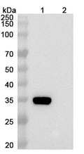 Anti-Human RIA/ALK-2/Activin Receptor Type 1 Reference Antibody (Prafnosbart) – Figure 1 of 2