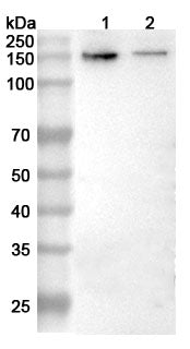 Western blot analysis was performed using anti-GRIN2B polyclonal antibody at 1ug/mL  on various samples.
Lane 1: Mouse brain lysate
Lane 2: Rat brain lysate