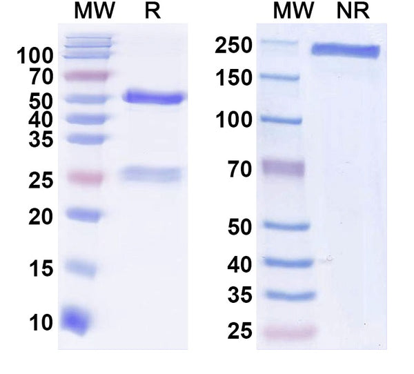 SDS-PAGE for Anti-GluN2B/NR2B glutamate receptor Antibody (N59/36)