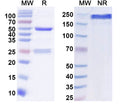 SDS-PAGE for Anti-GluN2B/NR2B glutamate receptor Antibody (N59/7)