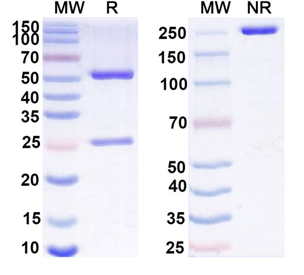 Anti-Human GAS6 Reference Antibody (KM5320) – Figure 1 of 1