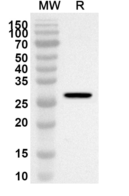 Western blot analysis was performed using anti-SELENBP1 polyclonal antibody at 1ug/mL on recombinant SELENBP1 (Catalog No. HC356012).