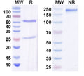 SDS-PAGE for Anti-GluN2C/NR2C glutamate receptor Antibody (N422/18)
